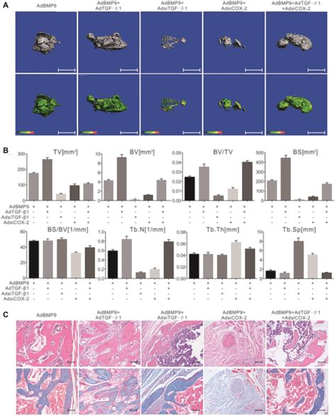 The Effect Of Tgf β1 And Cox 2 Knockdown On The Osteogenesis Induced By