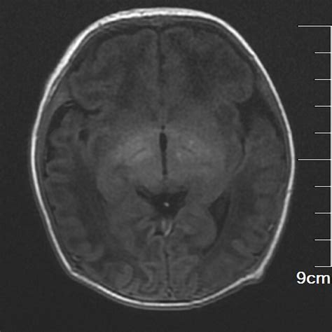 Cranial Magnetic Resonance Imaging Download Scientific Diagram