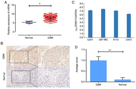 Expression Level Of ZWINT Is Upregulated In GBM Tissues And Cell Lines