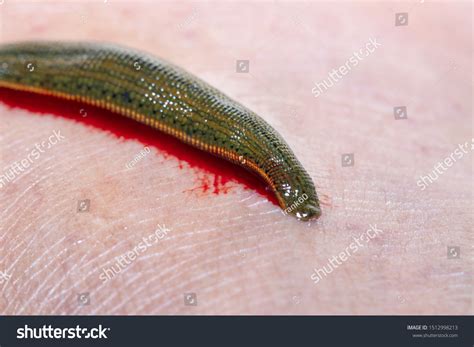 giant blood suckers leach