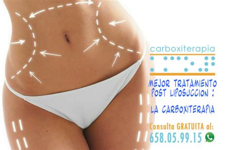 El Mejor Tratamiento Post Liposuccion Es La Carboxiterapia NO El Drenaje