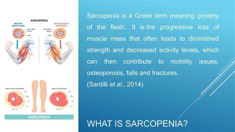 Sarcopenia Physiotherapy Symptoms Pptx