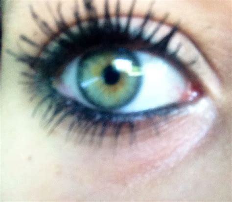 Blue Brown Ring Around Iris
