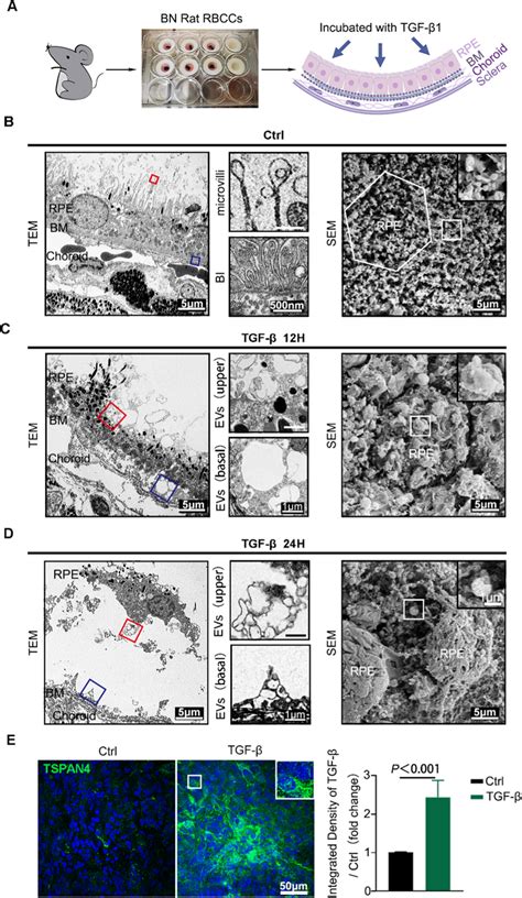 Observation Of Migrasome Formation And Production From Tgf Treated