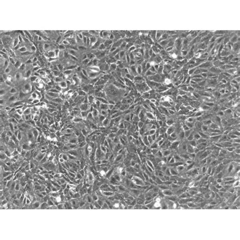 Human Umbilical Vein Endothelial Cells Huvec