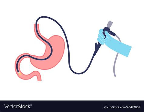 Esophagogastroduodenoscopy Medical Procedure Vector Image