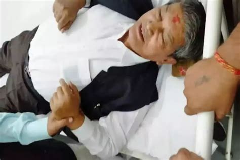 Harish Rawat Accident डिवाइडर से टकराई पूर्व सीएम हरीश रावत की