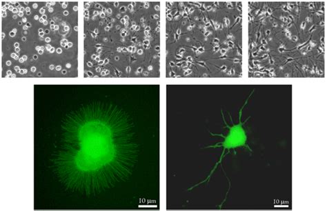 Neurite Outgrowth Araceli Biosciences