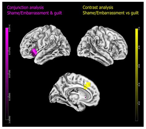 The Neural Signatures of Shame, Embarrassment, and Guilt: A Voxel-Based