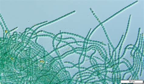 Nostoc - Cyanobacteria Guide