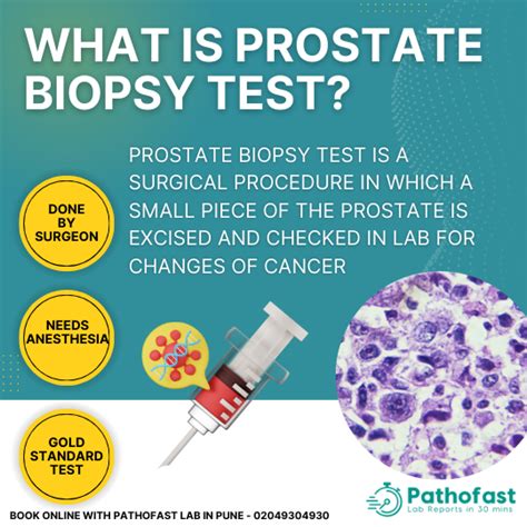 Best Tests For Prostate Cancer Screening And Diagnosis