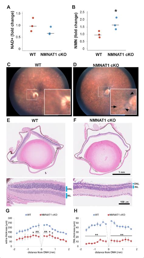 Nmnat Depletion Induces Severe Retinal Degeneration A B Metabolite