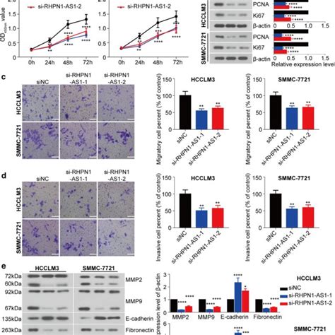 Knockdown Of Rhpn1 As1 Inhibited Proliferation Migration And Invasion Download Scientific