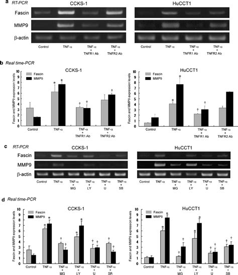 Alterations Of Fascin And MMP9 Expression Levels In Cholangiocarcinoma