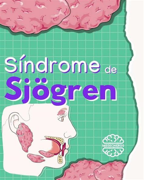 Síndrome de Sjögren YUDOC ORG uDocz