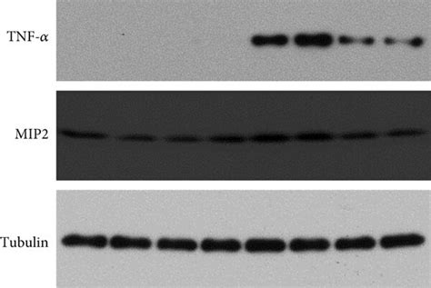 Apigenin Attenuates Lps Induced Cardiac Proinflammatory Cytokines A