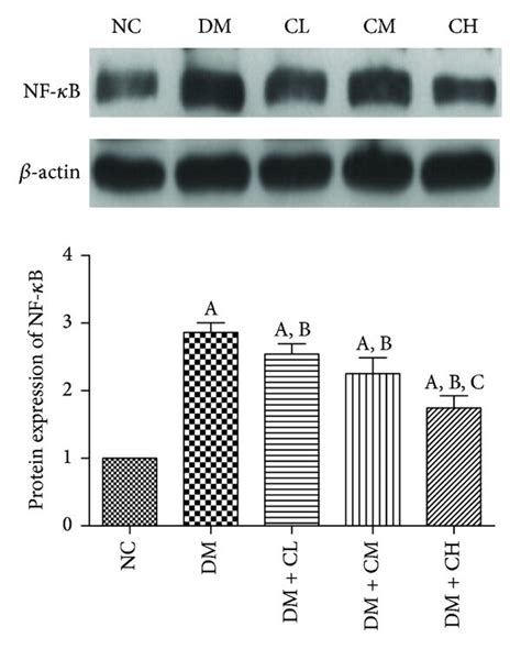 Celastrol administration downregulated NF κB and p IκBα expressions in