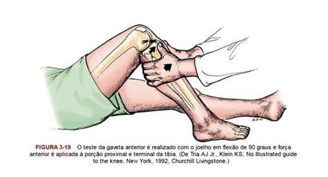 Lesão do Ligamento Cruzado Posterior Dr Oliver Ulson