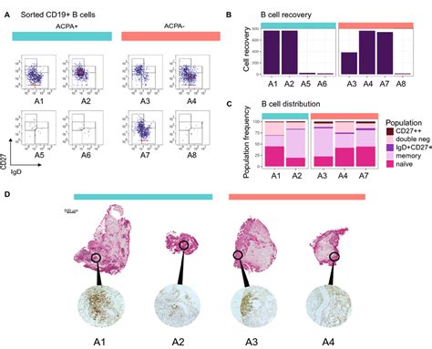 Number Phenotype And Spatial Distribution Of Synovial B Cells In