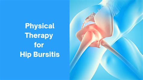 Physical Therapy For Hip Bursitis Mangiarelli Rehabilitation