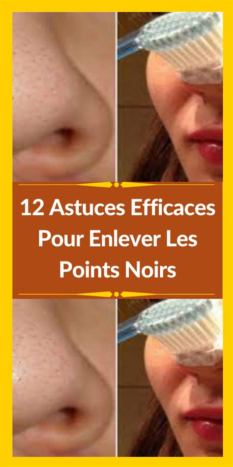 12 Astuces Efficaces Pour Enlever Les Points Noirs Artofit