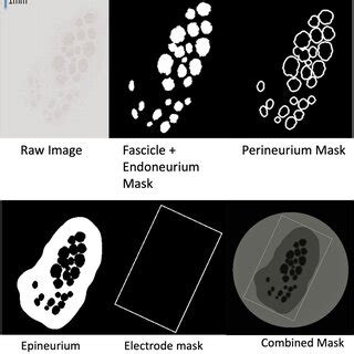 Material layer isolation. Raw image (top left), endoneurium mask (top... | Download Scientific ...