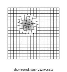 Amsler Eye Scotoma Test Grid Vector Stock Vector (Royalty Free ...