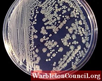 Enterobacter cloacae: characteristics, morphology, diseases - science ...