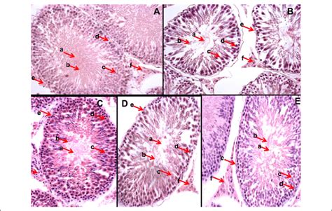 Histological Sections Taken From Testicular Tissues Of Different