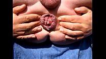 Deformed Pussy Search XVIDEOS