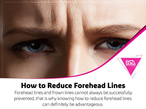 How To Reduce Forehead Lines