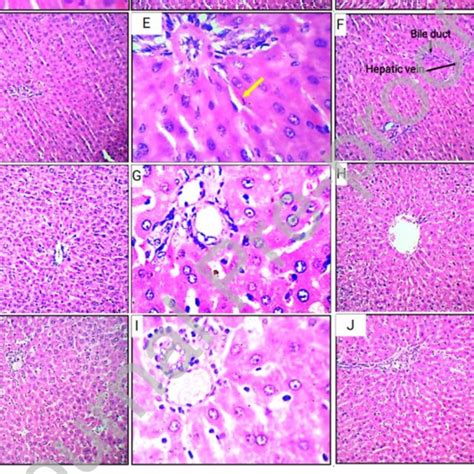 Representative Light Photomicrographs Of H And E Stained Liver Sections