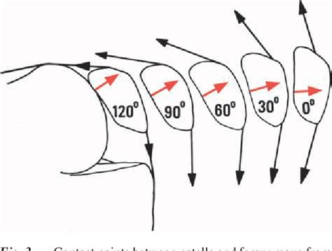 Figure 3 From Basic Kinematics And Biomechanics Of The Patello Femoral