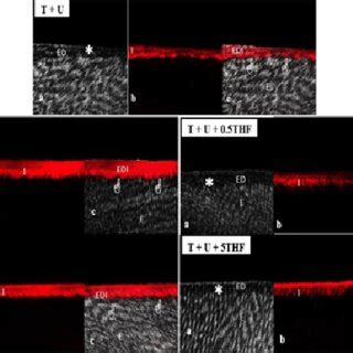 Confocal Micrographs Showing The Penetration Of The Experimental