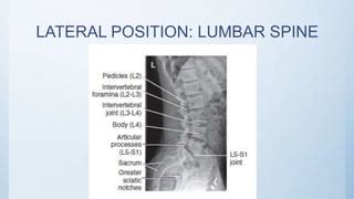 Radiographic Views Of Lumbar Spine Ppt