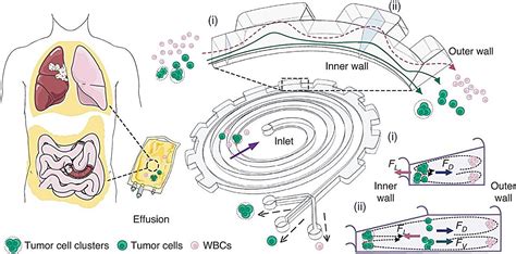 New Microfluidic Device For Cancer Detection Achieves Precise Separation Of Tumor Entities