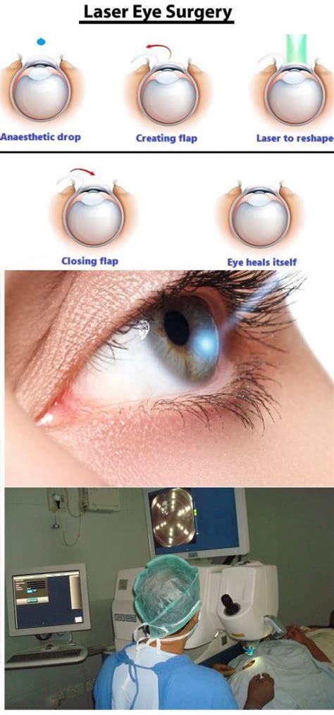 Laser Eye Surgery In Ghaziabad Laser Eye Treatment In Greater Noida