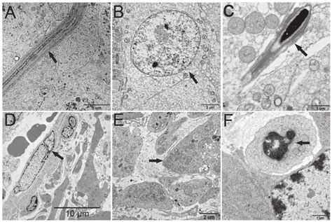 Electron Micrographs Of Testis Tissue From The Control And Experimental