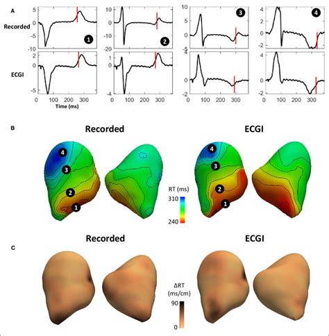 Evaluation Of Ecgi Reconstructed Electrograms Rt And Rt Gradients