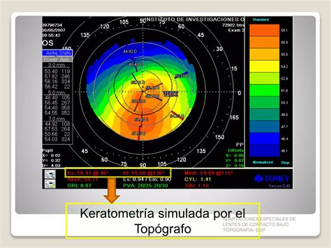 Interpretación básica de la Topografía Corneal PPT