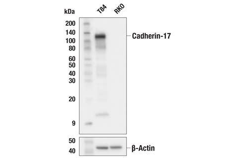 Cadherin E J Z Rabbit Mab Cell Signaling Technology