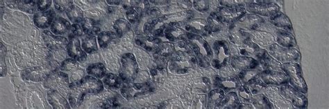 Super Resolution Microscope Leica Stellaris 8 With Falcon And Sted