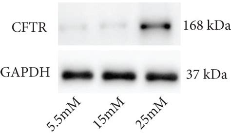 Hyperglycemia Inhibited Cell Proliferation And Suppressed The