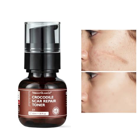 Vibrant Glamour Crocodile Scar Repair Toner Pimple Scar Dark Spots