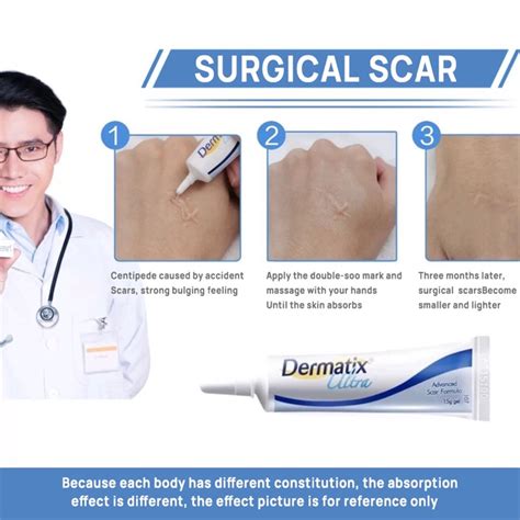 Dermatix Ultra Gel G Advanced Scar Gel Scar Removal Cream Reduction