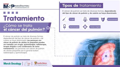 Pulmón y cancer Medicina y Salud Pública