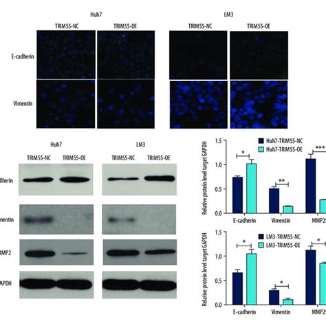 Overexpression Of Trim Inhibits Migration And Invasion Of Hcc Cells