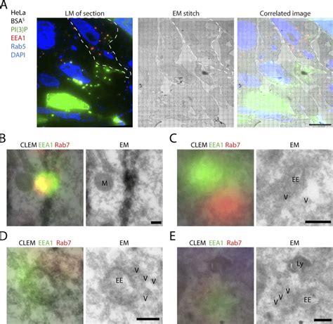 CLEM Of PI 3 P And Rab7 EEA1 Colocalization A On Section CLEM Of