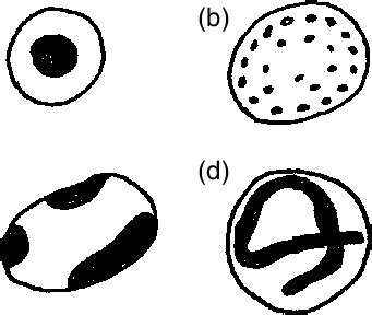 Basic Types Of Nuclei In Lobose Amoebae A Vesicular Nucleus With