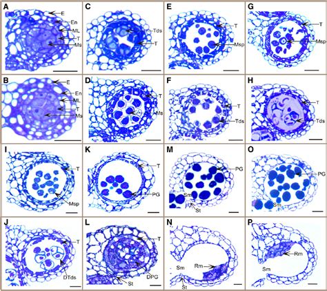 Comparison Of Wild Type And Cdm1 Anther Development Semithin Anther